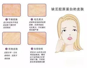 你可能不知道 胶原蛋白流失的无声疲惫与肌肤锁损